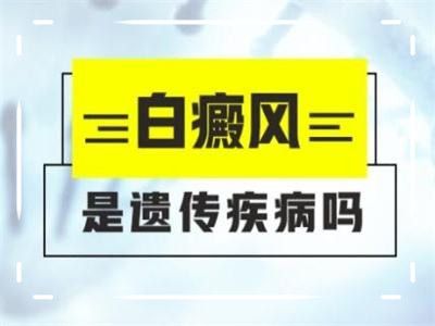 父母都有白癜风孩子遗传基因大吗？