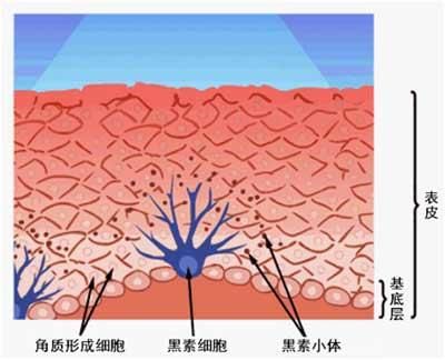 白癜风泛发型应如何护理？